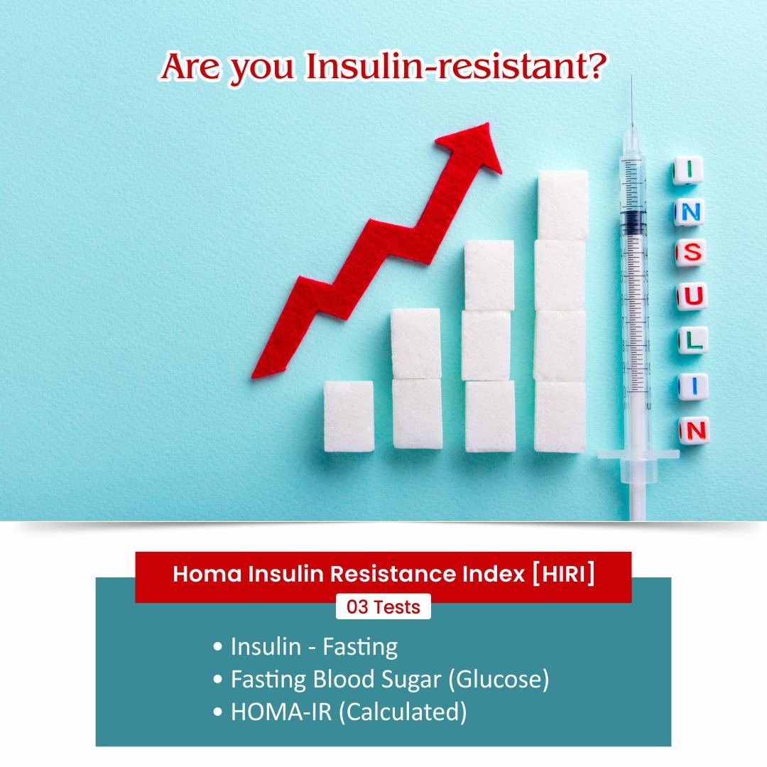 Homa Insulin Resistance Index Thyrocare Aarogyam Centre