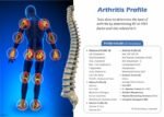 ARTHRITIS PROFILE