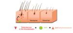 DIHYDROTESTOSTERONE (DHT)