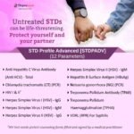 STD PROFILE ADVANCED