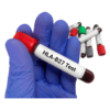 HLA-B27 FLOW CYTOMETRY