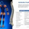 ARTHRITIS PROFILE