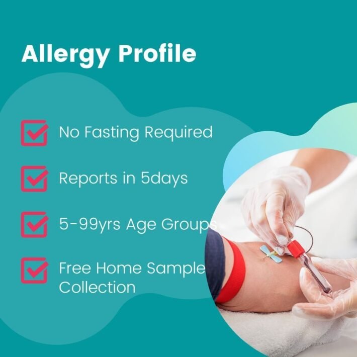 ALLERGY: BEEF – Thyrocare Aarogyam centre/Diagnostic Centre & Blood Test