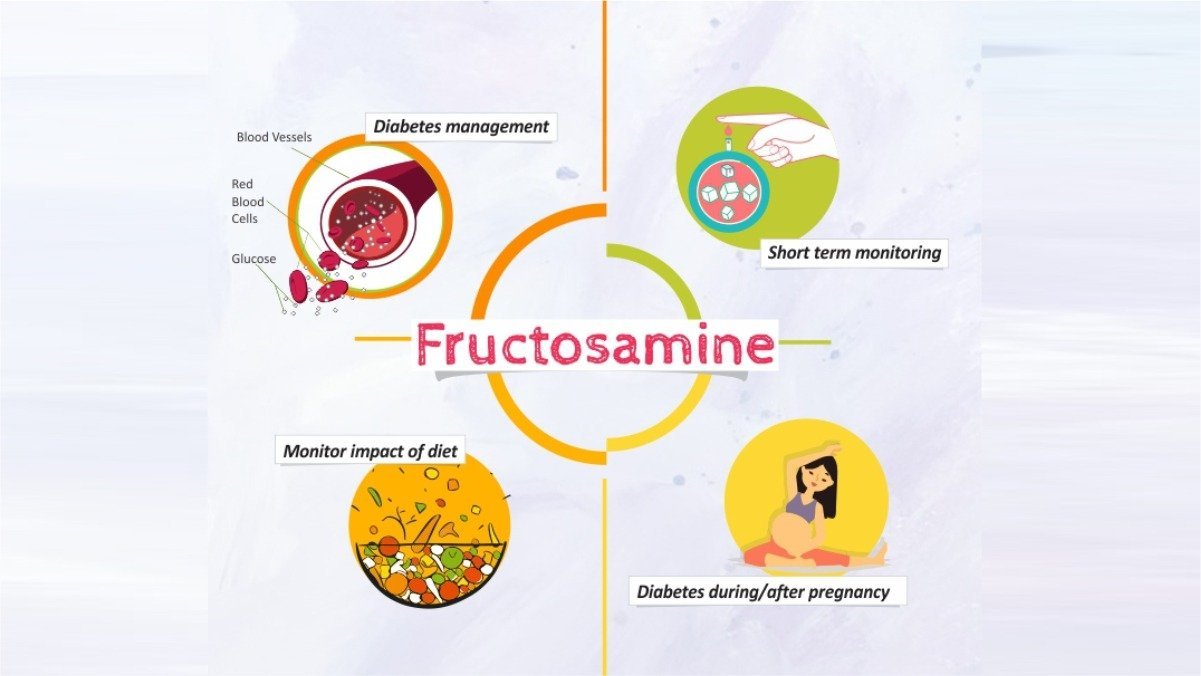 FRUCTOSAMINE