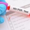 HIV 1 & 2 ANTIBODIES SCREENING TEST