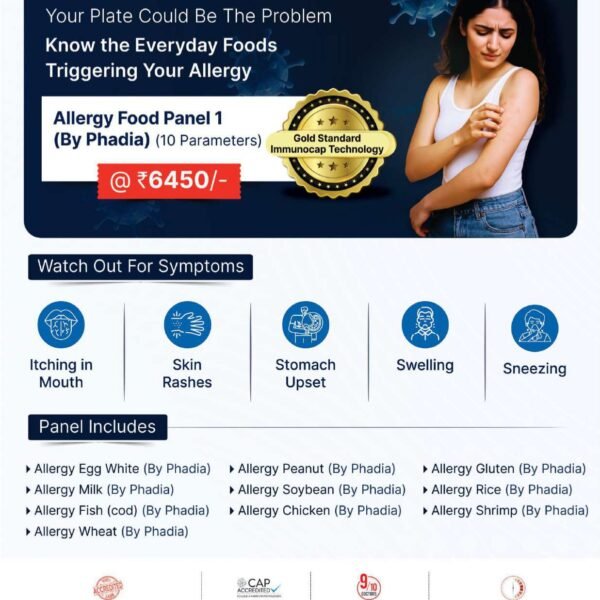 ALLERGY FOOD PANEL 1 (BY PHADIA)
