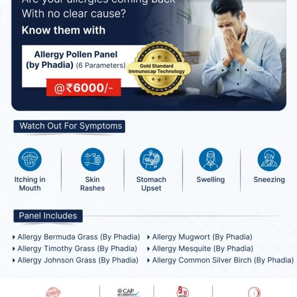 ALLERGY POLLEN PANEL (BY PHADIA)